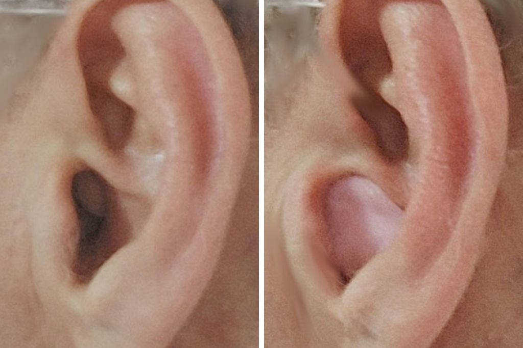 ThermaFit combined with Ohropax earplugs